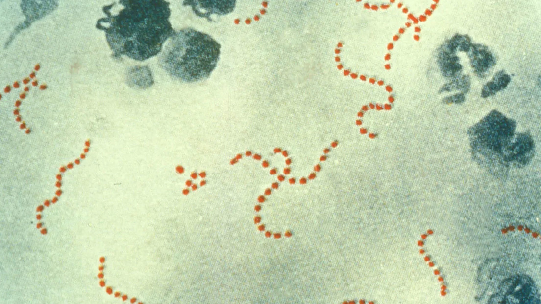 Japón registra cifras récords de infección por un estreptococo ‘carnívoro’ letal