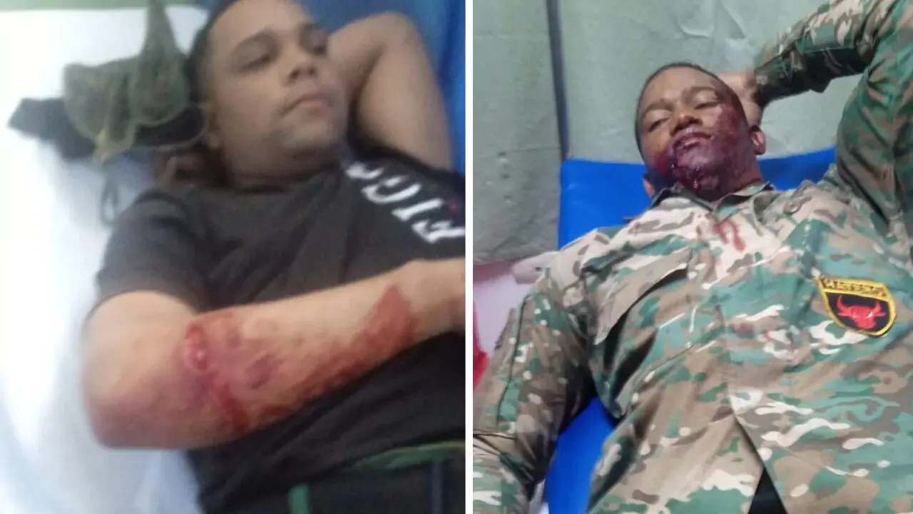 A pedradas y botellazos, haitianos agreden a dos miembros del Ejército en Azua